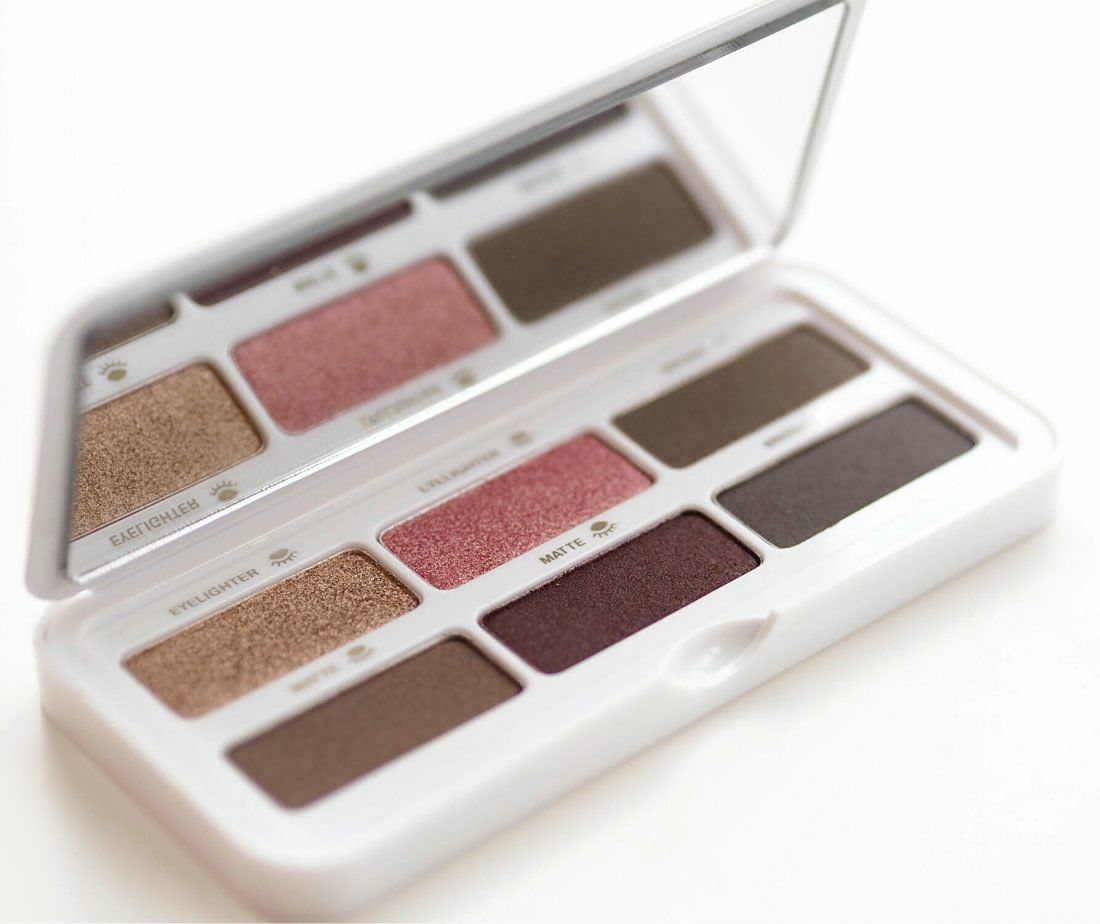 Criticam A Belinda Como Ele Se Parece Com Seus Novos Brackets 21